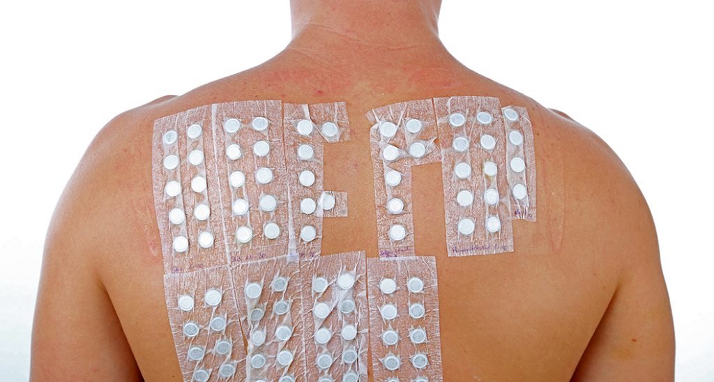 Contact Allergy Patch Testing Perth Dermatology Clinic