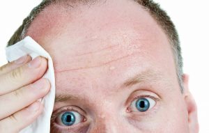 Sweating Hyperhidrosis Perth