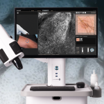 Confocal Microscopy